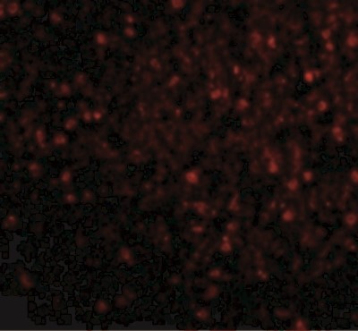 Immunofluorescence: BRSK2 Antibody [NBP1-77281] - BRSK2 in Human Brain cells with BRSK2 antibody at 20 ug/mL.