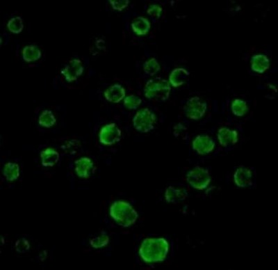 Immunocytochemistry/Immunofluorescence: TRAIL R2/TNFRSF10B Antibody [NBP1-76986] - HeLa cells.