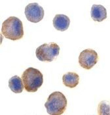 Immunocytochemistry/Immunofluorescence: TRAIL R2/TNFRSF10B Antibody [NBP1-76986] - Analysis of DR5 in formalin-fixed HeLa cells using NBP1-76986 at 5 ug/ml.
