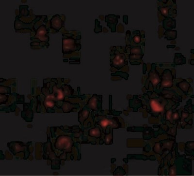 Immunocytochemistry/Immunofluorescence: DDX3 Antibody [NBP1-76686] - Immunofluorescence of DDX3 in HepG2 cells with DDX3 antibody at 20 ug/mL.