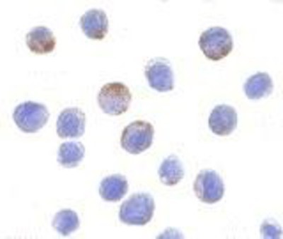 Immunocytochemistry/Immunofluorescence: DDX3 Antibody [NBP1-76686] - HepG2 cells with DDX3 antibody at 10 ug/ml.