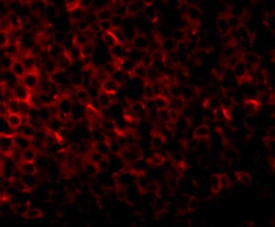 Immunocytochemistry/Immunofluorescence: PIGY Antibody [NBP1-77340] - Immunofluorescence of PIGY in human spleen tissue with PIGY1 antibody at 20 ug/mL.