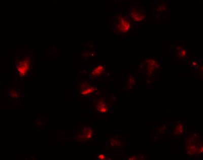 Immunocytochemistry/Immunofluorescence: Apc2 Antibody [NBP1-77376] - HeLa cells.