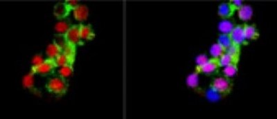 Immunocytochemistry/Immunofluorescence: MATH2/NEUROD6 Antibody [NBP2-29865] - Confocal  IF of PC12 using anti NeuroD6 Rabbit pAB (Red). Actin filaments have been labeled with Alexa Fluor 488 -Phalloidin (Green). Nuclear is stained with DAPI (Blue).