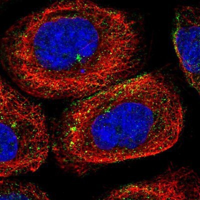 Immunocytochemistry/Immunofluorescence: Tubby Antibody [NBP1-87824] - Staining of human cell line A-431 shows positivity in plasma membrane and cytoplasm.