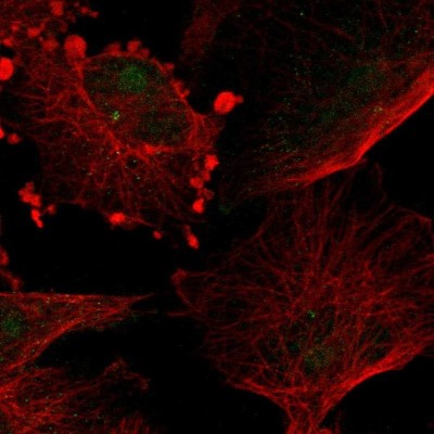Immunocytochemistry/Immunofluorescence: Tubby Antibody [NBP1-87824] - Immunofluorescent staining of human cell line U-251 MG shows localization to nucleoli & centrosome.