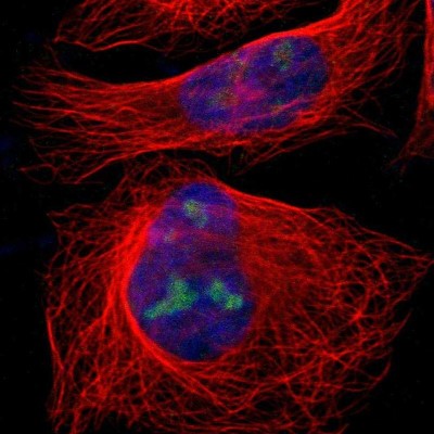 Immunocytochemistry/Immunofluorescence: IF3EI Antibody [NBP1-87955] - Immunofluorescent staining of human cell line U-2 OS shows localization to nucleus & nucleoli.
