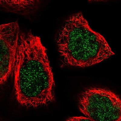 Immunocytochemistry/Immunofluorescence: AGXT2 Antibody [NBP1-89199] - Staining of human cell line A-431 shows positivity in nucleus but not nucleoli.