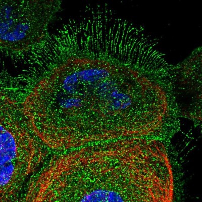 Immunocytochemistry/Immunofluorescence: DCUN1D2 Antibody [NBP1-88397] - Immunofluorescent staining of human cell line A-431 shows localization to plasma membrane & cytosol.