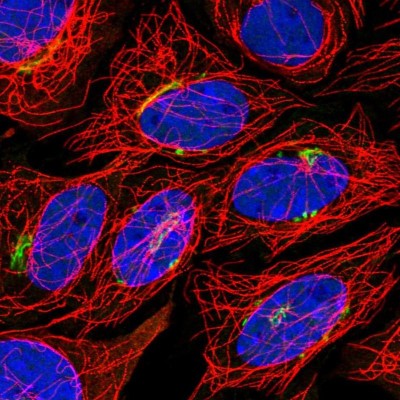 Immunocytochemistry/Immunofluorescence: TSHZ2 Antibody [NBP1-88303] - Immunofluorescent staining of human cell line SiHa shows localization to the Golgi apparatus.