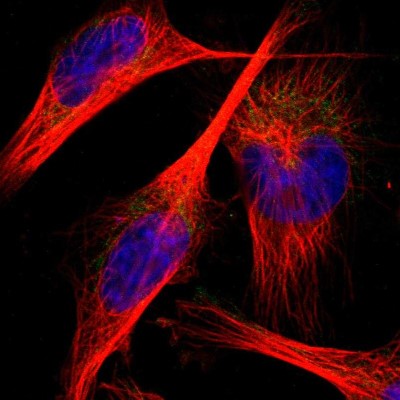 Immunocytochemistry/Immunofluorescence: PNKD Antibody [NBP1-88348] - Immunofluorescent staining of human cell line U-251 MG shows localization to mitochondria.