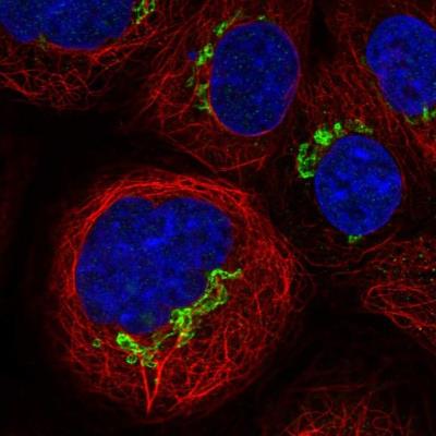 Immunocytochemistry/Immunofluorescence: PLET-1 Antibody [NBP1-90680] - Staining of human cell line A-431 shows positivity in golgi apparatus.