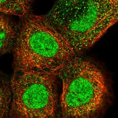 Immunocytochemistry/Immunofluorescence: Dystonin Antibody [NBP1-89946] - Immunofluorescent staining of human cell line A-431 shows localization to nucleus & cytosol.
