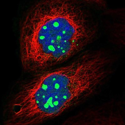 Immunocytochemistry/Immunofluorescence: GNL2 Antibody [NBP1-81649] - Immunofluorescent staining of human cell line A-431 shows localization to nucleoli.