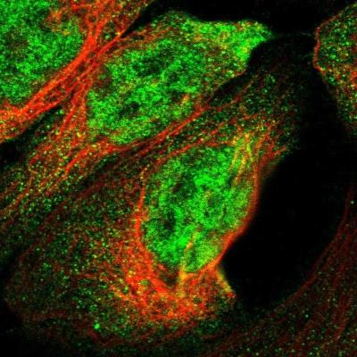 Immunocytochemistry/Immunofluorescence: RAD26L Antibody [NBP1-81944] - Staining of human cell line A-431 shows positivity in nucleus but not nucleoli and cytoplasm.