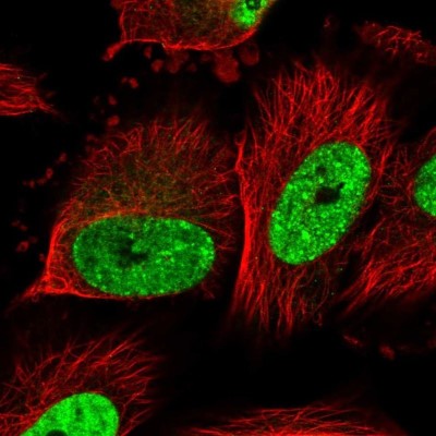 Immunocytochemistry/Immunofluorescence: SIM2 Antibody [NBP1-88619] - Staining of human cell line U-251 MG shows localization to nucleoplasm & nuclear bodies.