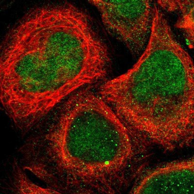 Immunocytochemistry/Immunofluorescence: ATF7 Antibody [NBP1-88876] - Staining of human cell line A-431 shows positivity in nucleus and cytoplasm.