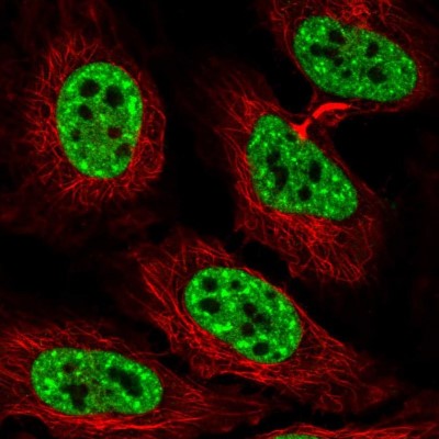 Immunocytochemistry/Immunofluorescence: Mohawk homeobox Antibody [NBP1-89912] - Immunofluorescent staining of human cell line HeLa shows localization to nuclear speckles.