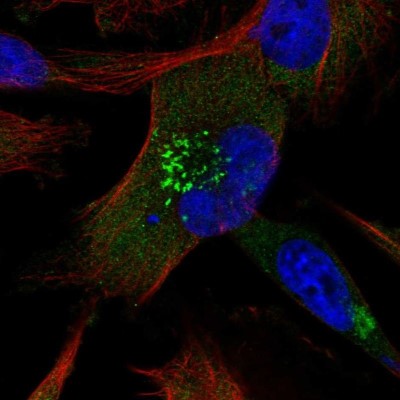 Immunocytochemistry/Immunofluorescence: ABCB6 Antibody [NBP1-91642] - Staining of human cell line U-251 MG shows localization to the Golgi apparatus.