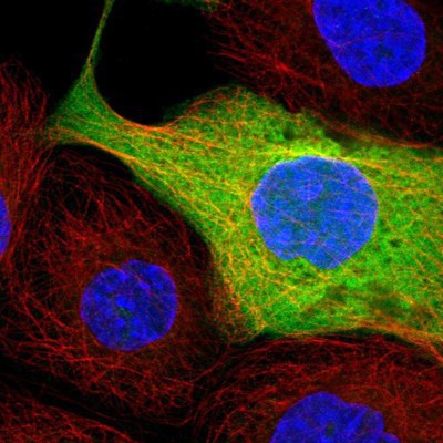 Immunocytochemistry/Immunofluorescence: AZI2 Antibody [NBP1-88924] - Staining of human cell line A-431 shows positivity in plasma membrane and cytoplasm.