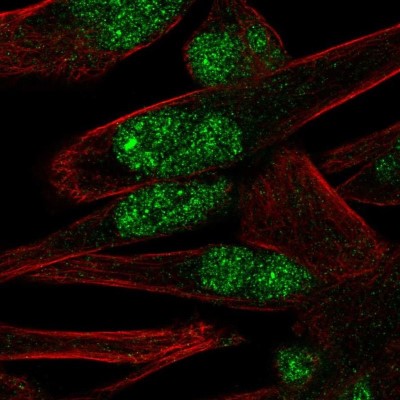 Immunocytochemistry/Immunofluorescence: PNMA-like 1 Antibody [NBP1-87913] - Staining of human cell line RH-30 shows localization to nucleoplasm & nuclear bodies.
