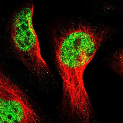 Immunocytochemistry/Immunofluorescence: ZNF233 Antibody [NBP1-81942] - Staining of human cell line U-2 OS shows positivity in nuclei but not nucleoli.