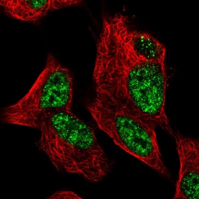 Immunocytochemistry/Immunofluorescence: ZNF233 Antibody [NBP1-81942] - Immunofluorescent staining of human cell line SH-SY5Y shows localization to nucleoplasm.