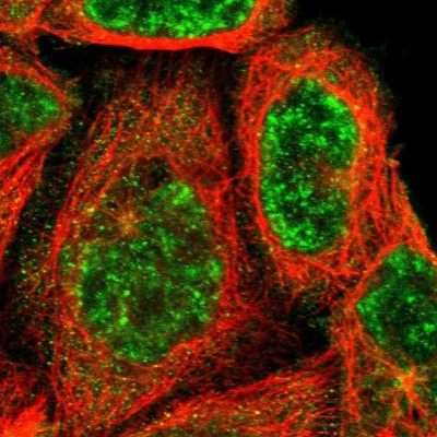 Immunocytochemistry/Immunofluorescence: ARMCX5 Antibody [NBP1-82274] - Staining of human cell line A-431 shows positivity in nucleus but not nucleoli and cytoplasm.