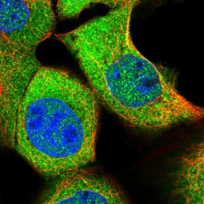 Immunocytochemistry/Immunofluorescence: ASZ1 Antibody [NBP1-89130] - Immunofluorescent staining of human cell line A-431 shows localization to nucleoplasm & cytosol.