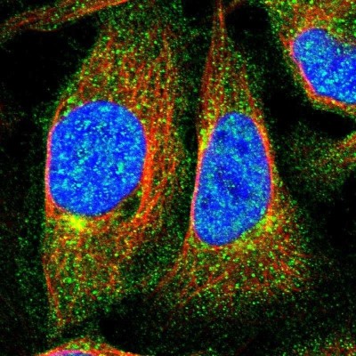 Immunocytochemistry/Immunofluorescence: C9orf25 Antibody [NBP1-88741] - Staining of human cell line U-2 OS shows positivity in nucleus but not nucleoli, golgi apparatus and vesicles.