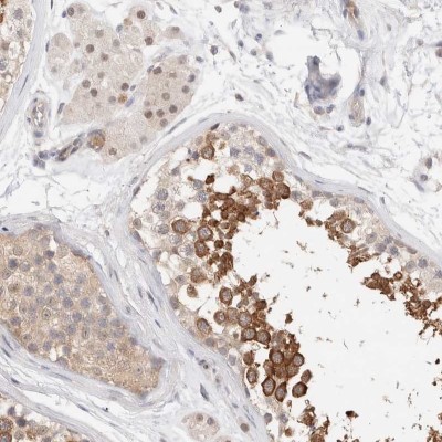 Immunocytochemistry/Immunofluorescence: C17orf97 Antibody [NBP1-81295] - Staining of human testis shows strong cytoplasmic positivity in subsets of seminiferus duct cells.