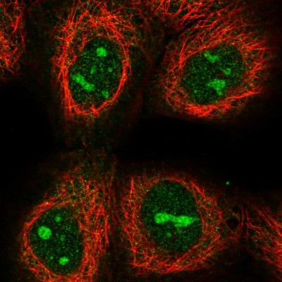 Immunocytochemistry/Immunofluorescence: C17orf97 Antibody [NBP1-81295] - Immunofluorescent staining of human cell line A-431 shows localization to nucleoli.