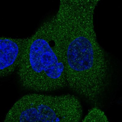 Immunocytochemistry/Immunofluorescence: FAM40B Antibody [NBP1-81435] - Immunofluorescent staining of human cell line A-431 shows localization to cytosol.