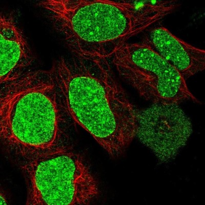 Immunocytochemistry/Immunofluorescence: Rif1 Antibody [NBP2-47303] - Staining  human cell line HEK 293 shows positivity in nucleus.
