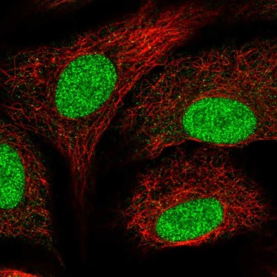 Immunocytochemistry/Immunofluorescence: SNAPC5 Antibody [NBP2-47267] - Immunofluorescent staining of human cell line A549 shows localization to nucleus & nucleoli.
