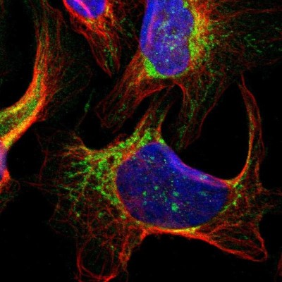 Immunocytochemistry/Immunofluorescence: SMYD5 Antibody [NBP2-47268] - Immunofluorescent staining of human cell line U-2 OS shows localization to mitochondria.
