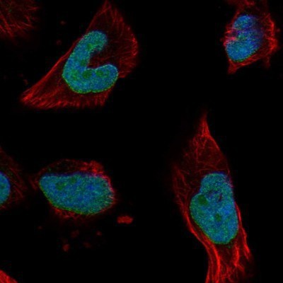 Immunocytochemistry/Immunofluorescence: WDR3 Antibody [NBP1-82281] - Staining of human cell line U-251MG shows positivity in nucleus, nucleoli and nuclear membrane.