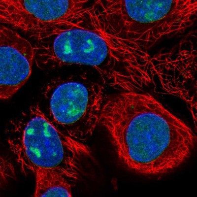Immunocytochemistry/Immunofluorescence: WDR3 Antibody [NBP1-82281] - Immunofluorescent staining of human cell line A-431 shows localization to nucleus, nucleoli & nuclear membrane.