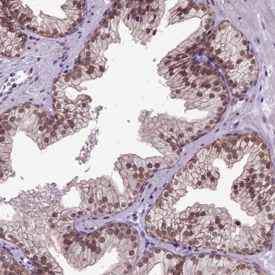 Immunocytochemistry/Immunofluorescence: ORC5L Antibody [NBP1-82476] - Staining of human prostate shows moderate nuclear positivity in glandular cells.