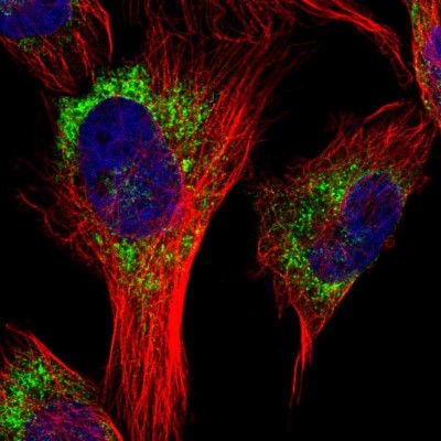 Immunocytochemistry/Immunofluorescence: GLT6D1 Antibody [NBP1-81822] - Staining of human cell line U-251MG shows positivity in endoplasmic reticulum.