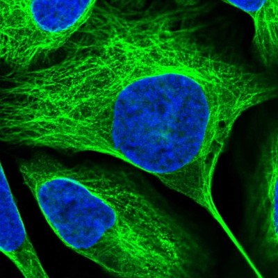 Immunocytochemistry/Immunofluorescence: ASRGL1 Antibody [NBP1-89133] - Immunofluorescent staining of human cell line U-2 OS shows localization to nucleoplasm & microtubules.