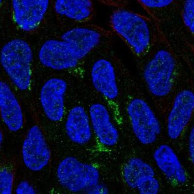 Immunocytochemistry/Immunofluorescence: NIPAL1 Antibody [NBP1-90518] -  staining of human cell line RT4 shows localization to the Golgi apparatus. Antibody staining is shown in green
