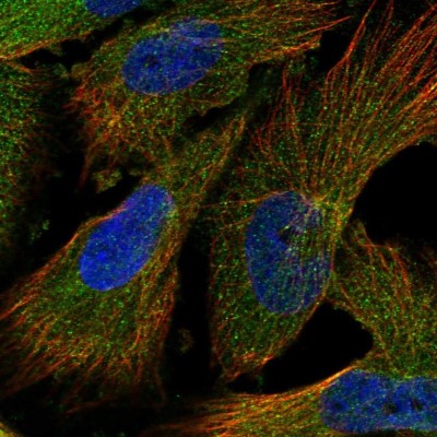 Immunocytochemistry/Immunofluorescence: INPP5B Antibody [NBP1-89439] - Immunofluorescent staining of human cell line U-251 MG shows localization to cytosol.