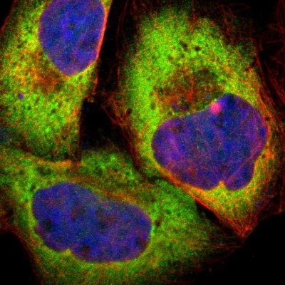 Immunocytochemistry/Immunofluorescence: PPP2R5E Antibody [NBP1-89464] - Immunofluorescent staining of human cell line A-431 shows localization to cytosol.
