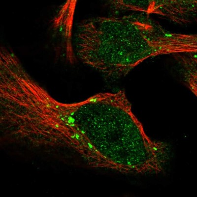 Immunocytochemistry/Immunofluorescence: PARG Antibody [NBP1-89450] - Immunofluorescent staining of human cell line U-2 OS shows localization to nucleoplasm & vesicles.