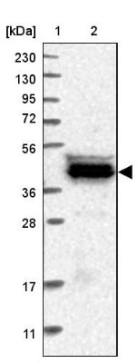 Western Blot: C9orf41 Antibody [NBP1-82048] - Lane 1: Marker [kDa] 230, 130, 95, 72, 56, 36, 28, 17, 11Lane 2: Human cell line RT-4