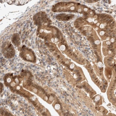 Immunohistochemistry-Paraffin: C9orf41 Antibody [NBP1-82048] - Staining of human duodenum shows moderate cytoplasmic and nuclear positivity in glandular cells.