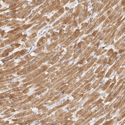 Immunocytochemistry/Immunofluorescence: TFB2M Antibody [NBP1-82114] - Staining of human heart muscle shows moderate cytoplasmic positivity in myocytes.