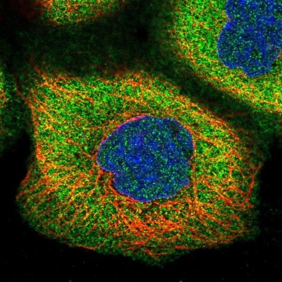 Immunocytochemistry/Immunofluorescence: C11orf10 Antibody [NBP1-91711] - Staining of human cell line A-431 shows positivity in plasma membrane and cytoplasm.