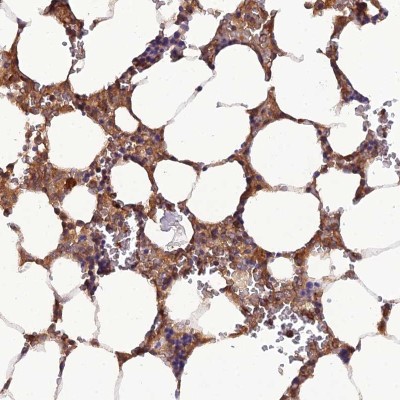Immunohistochemistry-Paraffin: C11orf10 Antibody [NBP1-91711] - Staining of human bone marrow shows moderate cytoplasmic positivity in hematopoietic cells.